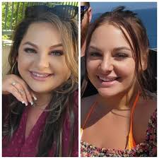 366 lbs 5'4 before and after pictures