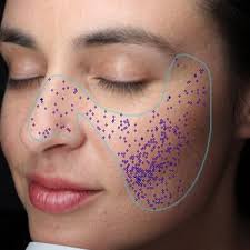 October special! Come in for a Free Visia scan to determine the health of  your skin AND get 20% off all products at the time of your scan! . . What is