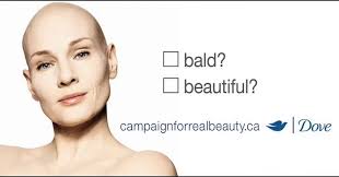 Alopecia World (@alopeciaworld) • Instagram photos and videos