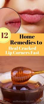 Pin On Essential Oils Natural Remedies