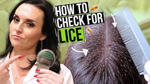 A nymph is a baby louse (singular for. Lice And Nits In African American Hair How To Remove Lice From A Big Beautiful Afro Youtube