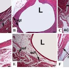 They might also do a biopsy, to take a small sample of tissue to test. Histopathological View Of Endometriosis Model In The Test Materials Download Scientific Diagram