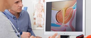 كما يستمر البروستات توسيع فإنه يمكن الضغط الزائد على مجرى البول (أنبوب صغير يحمل البول والسائل المنوي). Ø§Ù„Ø¨Ø±ÙˆØ³ØªØ§ØªØ§ Ø§Ø¹Ø±Ø§Ø¶ Ø§Ù„Ø¨Ø±ÙˆØ³ØªØ§ØªØ§ ÙˆÙŠØ¨ Ø·Ø¨