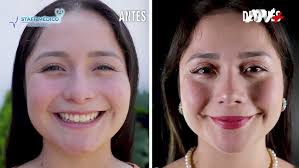 🤩Eliza Ayala se realizo una Rinoseptoplastia y Lipopapada