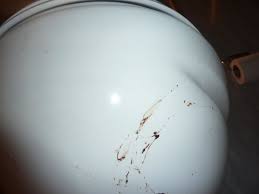Stains On Toilet Picture Of Britannia Sachas Hotel Manchester Tripadvisor