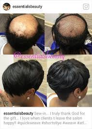 Alopecia Hair Styles Alopecia Hairstyles Quick Weave Hairstyles Short Weave Hairstyles