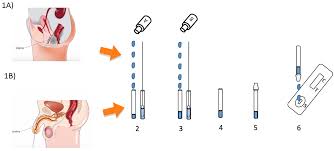 Test til klamydia/mycoplasma er en hjemmetest til påvisning af netop disse infektioner. Klamydiatest Svar Inden For 10 Minmedtest Shop