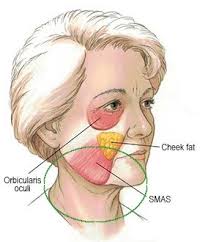 Check spelling or type a new query. Specialist Jowl Lift Surgeon Dr Jason Roth Sydney
