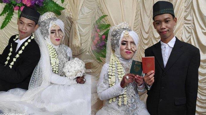 Hasil gambar untuk VIRAL Pria Ini Nikahi Wanita dengan Kondisi Cacat Mata Banjir Pujian Warganet, Disebut Cinta Sejati