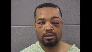 Chicago man shot by DEA agent in 2014 files lawsuit