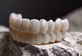 Zirconia Crowns for Front Teeth ...