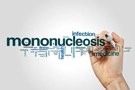 Tender, swollen lymph nodes on the sides and back of your neck; Mononucleosis Symptoms Causes Diagnosis And Treatment