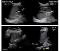Check spelling or type a new query. Pediatric Abdominal Ultrasound A Comprehensive Guide To Making The Diagnosis Part I 2018 06 15 Ahc Media Continuing Medical Education Publishing