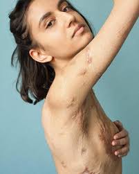 Cicatrici, il progetto fotografico