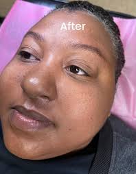 What if your eyebrows to light or thin, Nanobrows Hairstroke would be your  best choice. Message me for more informations