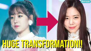Namjoo joined cube entertainment through the 2010 cube party auditions and was one of the last apink members to be. Apink Namjoo Plastic Surgery Becomes Viral News Plan A Refused To Comment Youtube