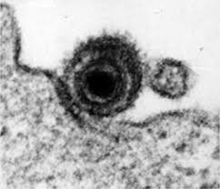 Epstein Barr Virus Von Harmlos Bis Folgenschwer