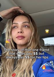 How do they always have money for their lips though?? 🤔💋 @kianna  #lipfiller #medspa #fyp #trending #medspalife #denver #denvercolorado