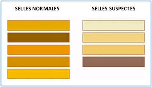 Cholestase Neonatale Sciencedirect Mastic à l’huile de lin supports : sciencedirect com