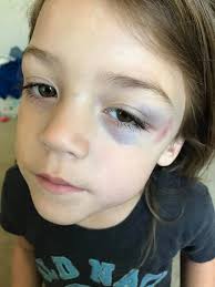 HHR Car Snow Driving and Repair