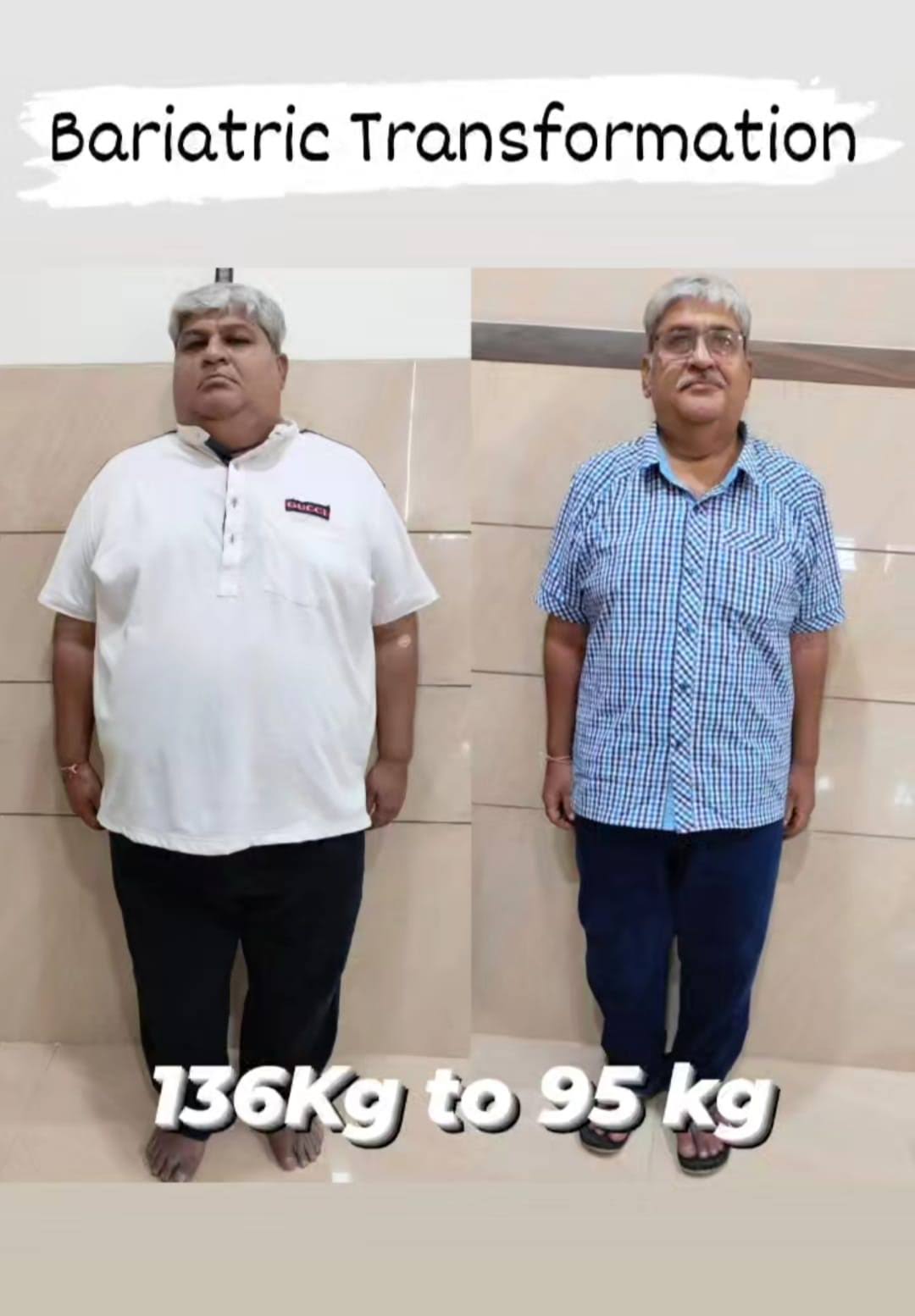 Weight loss surgery (Bariatric surgery) product image