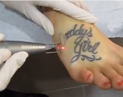 Maybe you would like to learn more about one of these? Tattoo Removal New Image Medical Spa Rancho Cucamonga Ca