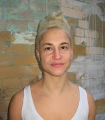 Topic: Gender realignment surgery