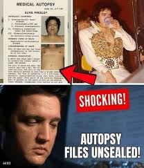 The Elvis Presley Autopsy Files Have Finally Been Unveiled — and the Findings Aren't Promising!