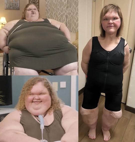 Tammy Slaton, star of 1000-lb Sisters, is barely recognizable after extreme  weight loss and skin removal surgery. : r/mildyinteresting