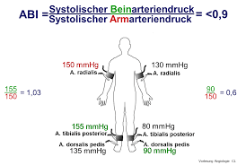 Knochel Arm Index Kardiologisch Angiologische Praxis