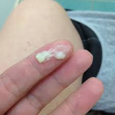 Seven weeks pregnant means you're one month and about three weeks pregnant, but keep in mind that doctors generally refer to pregnancy by week that said, at 7 weeks pregnant, you may very well have no symptoms at all. Mucus Plug So I M 7 Weeks 4 Days Pregnant And Almost Everyday I Get A Blob Of Discharge Like This I M Assuming It S My Mucus Plug Forming But Should It