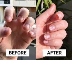 Thanks to naiouk channel on youtube for this great video. How To Stop Nail Biting After 20 Years This Is How I Finally Broke My Biting Habit