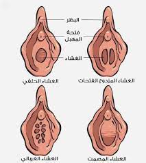 غشاء بكارة سليم حقيقي صور مهمة للغشاء البكارة السليم كلام نسوان
