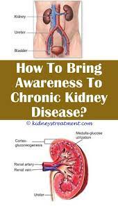 Pin On Kidney Disease