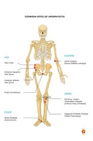 Image result for Hip Apophysitis