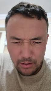 Туникасоз Уста