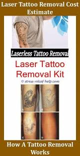 View latest posts and stories by @artrooijakkers art rooijakkers in instagram. Tattoo Removal Kit Tattoo Design