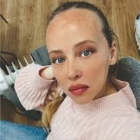 10+ "Alperowicz" profiles