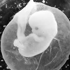 We did not find results for: Abtreibung Welche Folgen Hat Ein Schwangerschaftsabbruch Quarks De