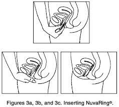I have heard that nuvaring is the one of the best method of birth control. Nuvaring Organon Usa Drug Reference Encyclopedia