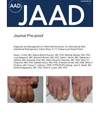 Image result for Yellow nail syndrome feet