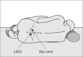 Two possible patient positions are utilized for lumbar puncture. Appropriate Patient Positioning For Lumbar Puncture Grepmed