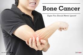 The most common sites for these tumors in younger people are around the knee or in the upper arm, but they can occur in other bones as well. Bone Cancer Signs You Should Never Ignore By Dr Anand Narayan Lybrate