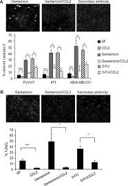 Best actor best leading actor award, golden bell awards 2014 star awards 2010 : Ccl2 Ccr2 Chemokine Signaling Coordinates Survival And Motility Of Breast Cancer Cells Through Smad3 Protein And P42 44 Mitogen Activated Protein Kinase Mapk Dependent Mechanisms Journal Of Biological Chemistry