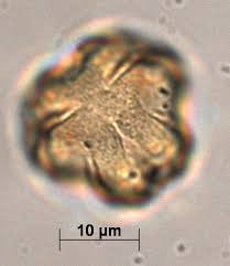 Image result for Dissotis irvingiana