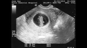 We did not find results for: Ultrasound Spoof Fake Free Apps 148apps