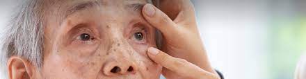 You need to go to an eye doctor for emergency eye care services also when you have any eye infection, abrasions, burns, eyelid lumps, allergies or any eye inflammatory conditions. Emergency Eye Care Advanced Eye Physician New York