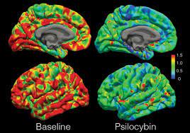 Psychedelic Effects Of Psilocybin Correlate With Serotonin 2a Receptor Occupancy And Plasma Psilocin Levels Abstract Europe Pmc