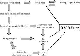 Tetralogy of fallot consists of 4 features: Right Ventricular Failure Continuing Education In Anaesthesia Critical Care And Pain