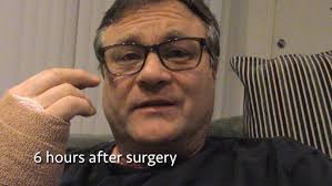 All About Carpal Tunnel with Dr. Eric Angermeier